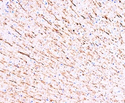 IHC-P: MAP1 antibody testing of rat brain tissue. HIER: steamed with pH6 citrate buffer, HRP-staining.