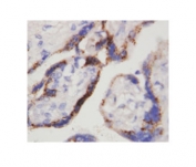 IHC-P: beta-HCG antibody testing of human placenta tissue. HIER: steamed with pH6 citrate buffer, HRP-staining.