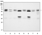 Western blot testing of 1) human 293T, 2) human MCF7, 3) human U-87 MG, 4) rat brain, 5) rat C-6, 6) mouse brain, 7) mouse Neuro-2a and 8) mouse C2C12 cell lysate with SSH3BP1 antibody. Predicted molecular weight ~55 kDa, commonly observed at 55-65 kDa.