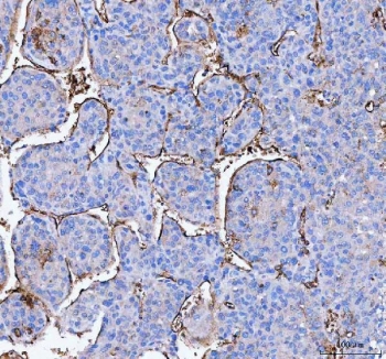 Western blot testing of AQP1 antibody and Lane 1: rat kidney; 2: rat lung; 3: SMMC-7721 cell lysate