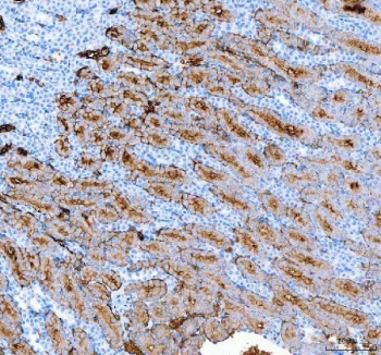 IHC staining of FFPE mouse kidney tissue with AQP1 antibody. HIER: boil tissue sections in pH8 EDTA for 20 min and allow to cool before testing.