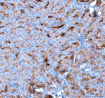 IHC staining of FFPE rat kidney tissue with AQP1 antibody. HIER: boil tissue sections in pH8 EDTA for 20 min and allow to cool before testing.