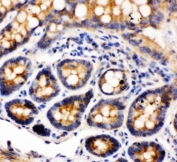 IHC-P: Integrin alpha 1 antibody testing of rat intestine tissue. HIER: steamed with pH6 citrate buffer.