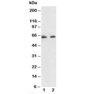 Western blot testing of p65 antibody and Lane 1: human colon cancer; 2: HeLa lysate