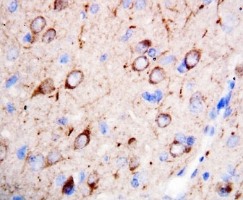 IHC-P: nNOS antibody testing of rat brain tissue