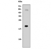 Western blot testing of human PC-3 cell lysate with IL-7 antibody.