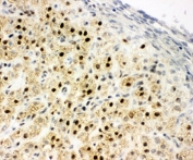 IHC-F: MTA1 antibody testing of rat ovary tissue
