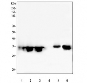 Western blot testing of 1) human Caco-2, 2) human HeLa, 3) human A431, 4) human SH-SY5Y, 5) rat lung and 6) mouse lung tissue lysate with Annexin A3 antibody. Predicted molecular weight ~36 kDa.