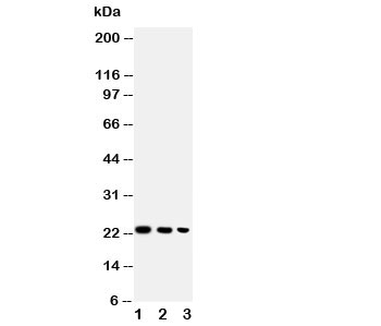 Western blot testing of BAFF antibody and Lane 1: recombinant human protein 10ng; 2: 5ng; 3: 2.5ng~