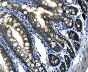 IHC staining of FFPE rat intestine with Desmoglein 2 antibody. HIER: boil tissue sections in pH8 EDTA buffer, for 20 min and allow to cool before testing.
