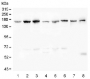 Western blot testing of human 1) K562, 2) HeLa, 3) HepG2, 4) A549, 5) Caco-2, 6) SW620, 7) rat liver and 8) mouse liver lysate with Desmoglein 2 antibody. Expected molecular weight: 122-160 kDa depending on glycosylation level.