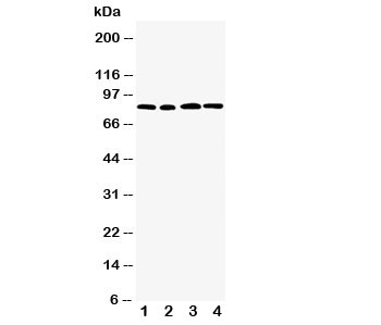 Western blot testing of CD168 antibody and Lane 1: MM231; 2: MM453; 3: HeLa; 4: A549 cell lysate~