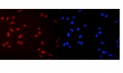 Immunofluorescent staining of FFPE human U-2 OS cells with MCM2 antibody (red) and DAPI nuclear stain (blue). HIER: steam section in pH6 citrate buffer for 20 min.