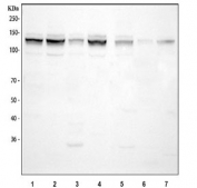 Western blot testing of 1) human HeLa, 2) human 293T, 3) human Jurkat, 4) human MCF7, 5) rat C6, 6) mouse spleen and 7) mouse NIH 3T3 cell lysate with MCM2 antibody. Predicted molecular weight: 100~130 kDa.