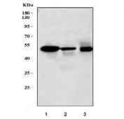 Western blot testing of 1) human liver, 2) rat liver and 3) mouse liver lysate with SLC10A1 antibody. Expected molecular weight: 38~56 kDa.