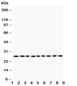 Western blot testing of Kallikrein 6 antibody and Lane 1: MCF-7; 2: HeLa; 3: MM231; 4: MM453; 5: A549; 6: SMMC-7721; 7: COLO320; 8: SW620; 9: HT1080