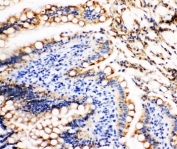 IHC-P: Vinculin antibody testing of rat intestine tissue. Required HIER: steam section in pH6 citrate buffer for 20 min.