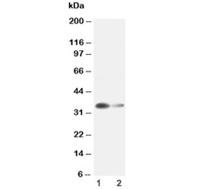 Western blot testing of Arginase 1 antibody and Lane 1: rat liver ; 2: rat kidney lysate~