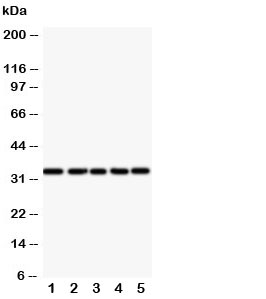 Western blot testing of E2F6 antibody and Lane 1: HeLa; 2: COLO320; 3: A549; 4: MCF-7; 5: SMMC-7721 cell lysate