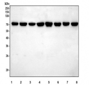 Western blot testing of human 1) HeLa, 2) HepG2, 3) A431, 4) MCF7, 5) A549, 6) PC-3, 7) 293T and 8) K562 cell lysate with HSP70 antibody. Expected molecular weight ~70 kDa.