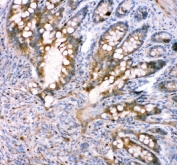 IHC staining of FFPE rat intestine tissue with FABP5 antibody. HIER: boil tissue sections in pH8 EDTA for 20 min and allow to cool before testing.