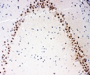 IHC-P: MEKK3 antibody testing of rat brain tissue