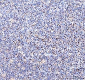 IHC staining of FFPE human tonsil tissue with TFAM antibody. HIER: boil tissue sections in pH8 EDTA for 20 min and allow to cool before testing.