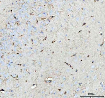 IHC staining of FFPE mouse brain tissue with Aquaporin 4 antibody. HIER: boil tissue sections in pH8 EDTA for 20 min and allow to cool before testing.