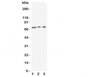 Western blot testing of VGF antibody and Lane 1: human U87;  2: (h) SHG-44;  3: mouse Neuro-2a cell lysate.  Expected molecular weight: ~90/70kDa (unprocessed/processed).