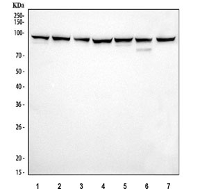 Western blot testing of 1) rat brain, 2) rat lung, 3) rat stomach, 4) rat C6, 5) mouse brain, 6) mouse lung and 7) mouse RAW264.7 cell lysate with VCP antibody. Predicted molecular weight ~89 kDa, commonly observed at 89-97 kDa.