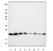 Western blot testing of 1) human U-87 MG, 2) human HepG2, 3) human Caco-2, 4) human 293T, 5) rat brain, 6) rat lung, 7) mouse brain and 8) mouse lung tissue lysate with Cyclophilin B antibody. Expected molecular weight 19-23 kDa.