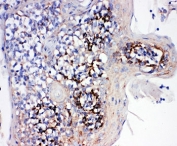 IHC-P: Cyclophilin B antibody testing of human tonsil tissue. HIER: boil tissue sections in pH6 citrate buffer for 20 min and allow to cool before testing.