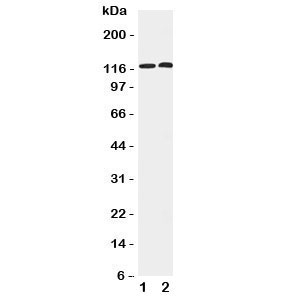 Western blot testing of HDAC5 antibody and Lane 1: HeLa; 2: COLO320 cell lysate. Expected/observed size ~122KD
