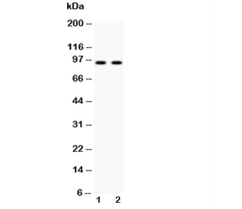 Western blot testing of Cadherin 17 antibody and Lane 1: HeLa; 2: SW620 lysate