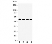 Western blot testing of Antithrombin III antibody and Lane 1:  rat testis;  2: SMMC-7721;  3: Jurkat;  4: Raji cell lysate.  Expected/observed size ~52KD