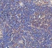 IHC staining of FFPE mouse spleen tissue with IL1 beta antibody. HIER: boil tissue sections in pH8 EDTA for 20 min and allow to cool before testing.