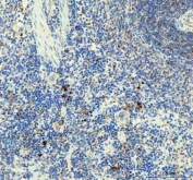 IHC staining of FFPE rat spleen tissue with IL1 beta antibody. HIER: boil tissue sections in pH8 EDTA for 20 min and allow to cool before testing.