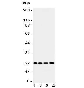 Western blot testing of Bid antibody and Lane 1: HeLa; 2: COLO320; 3: Jurkat; 4: SKOV lysate. Expected/observed size ~22KD