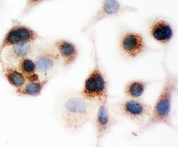 ICC testing of Bid antibody and A549 cells