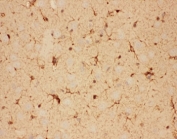 IHC-P: CNTF antibody testing of rat brain tissue