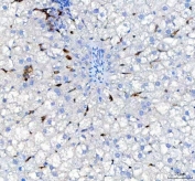 IHC staining of FFPE rat liver tissue with Heme Oxygenase 1 antibody. HIER: boil tissue sections in pH8 EDTA for 20 min and allow to cool before testing.