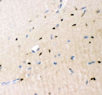 IHC staining of FFPE mouse brain tissue with Crk antibody. HIER: boil tissue sections in pH8 EDTA for 20 min and allow to cool before testing.