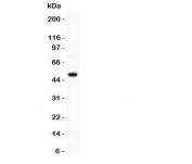 Western blot testing of CSK antibody and recombinant human protein (0.5ng)