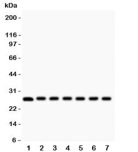 Western blot testing of Galectin 3 antibody and mouse samples 1: kidney; 2: liver; 3: spleen; 4: ovary; 5: HEPA; 6: ANA-1; 7: NIH3T3 lysate. Predicted/observed size ~26KD