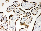 IHC-P: Nod1 antibody testing of human placenta tissue. HIER: steam section in pH6 citrate buffer for 20 min and allow to cool prior to testing.
