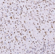 IHC staining of FFPE mouse brain tissue with Optineurin antibody. HIER: boil tissue sections in pH8 EDTA for 20 min and allow to cool before testing.  