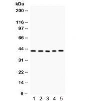 Western blot testing of 1) rat thymus, 2) rat skeletal muscle, 3) human A431, 4) SGC, 5) 22RV1 lysate with CCN1 antibody. Predicted/observed molecular weight ~42 kDa.