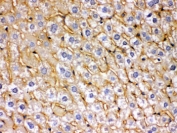 IHC testing of FFPE mouse liver with SOD3 antibody. HIER: Boil the paraffin sections in pH 6, 10mM citrate buffer for 20 minutes and allow to cool prior to staining.