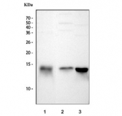 Western blot testing of 1) human HCCT, 2) monkey liver and 3) chicken liver tissue lysate with FABP antibody. Predicted molecular weight: ~14 kDa.