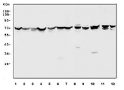 Western blot testing of human 1) HeLa, 2) A549, 3) HepG2, 4) Caco-2, 5) SW620, 6) PANCC-1, 7) Raji, 8) rat brain, 9) rat kidney, 10) mouse kidney, 11) mouse NIH 3T3 and 12) mouse RAW264.7 cell lysate with HSP70 antibody. Expected molecular weight ~70 kDa.